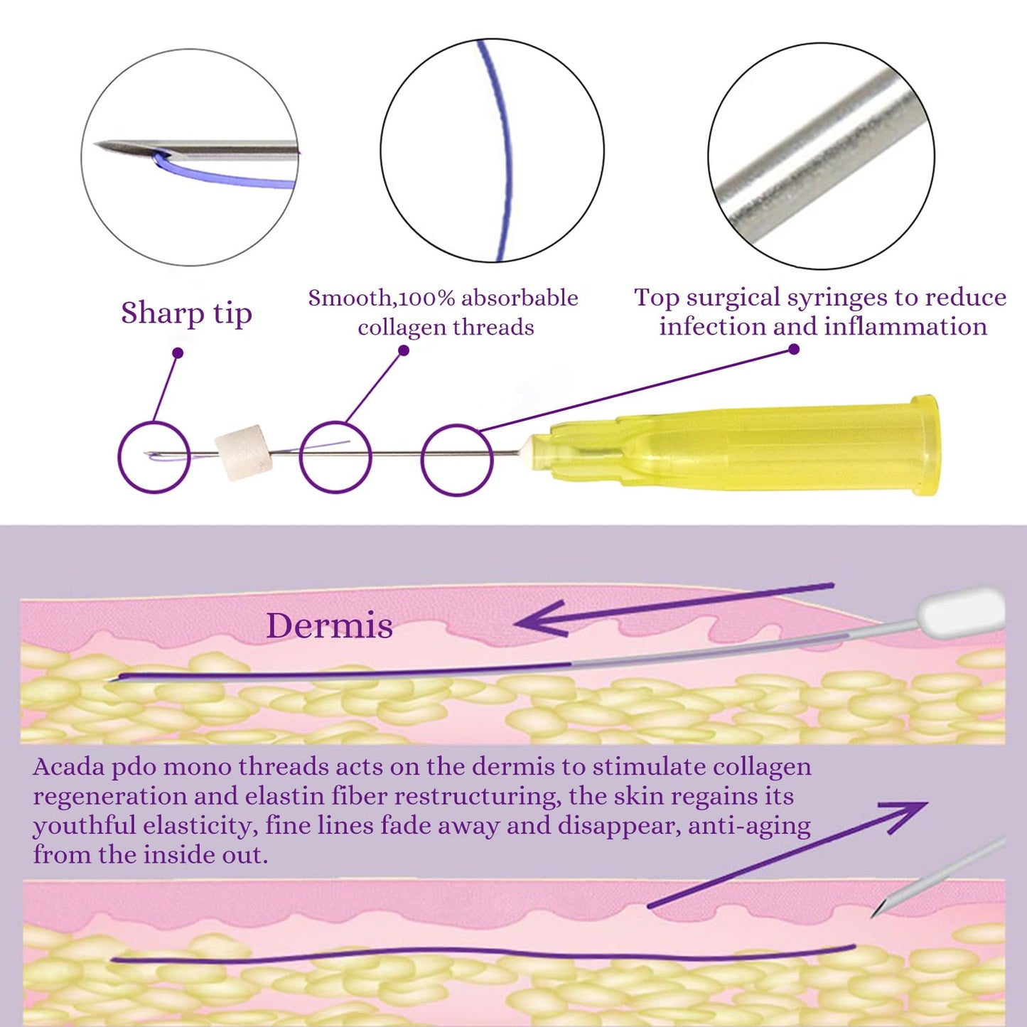 PDO Mono Smooth Collagen Threads for Face Lift - 20pcs