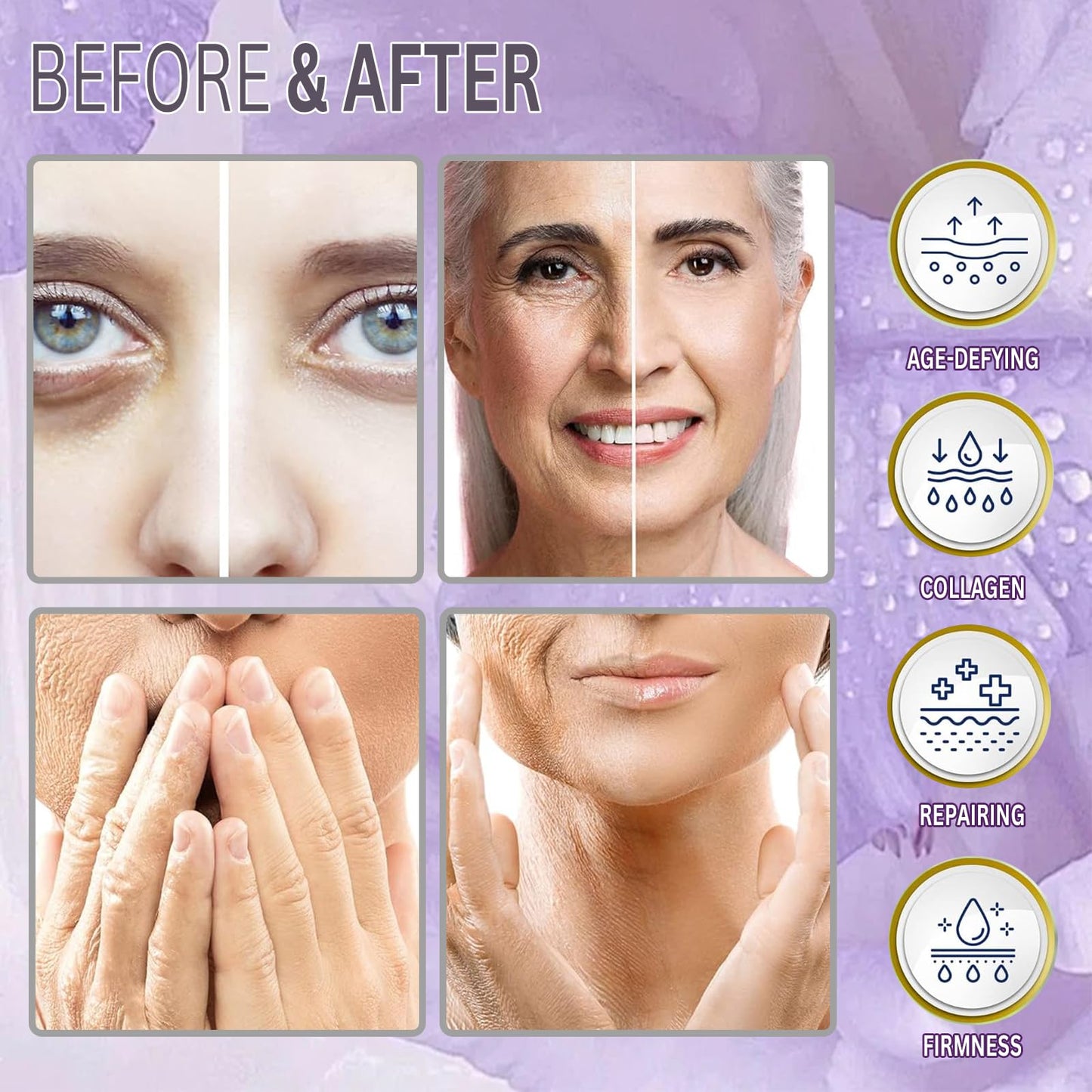 PDO Mono Smooth Collagen Threads for Face Lift - 20pcs