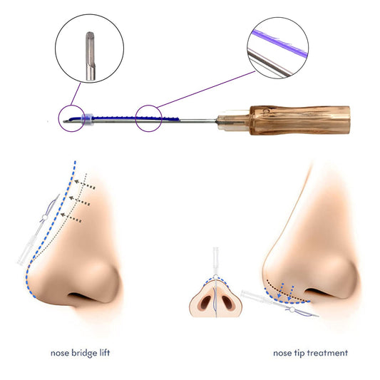 Nasal Thread Cog PDO Threads for Nose Dorsum Lift, L-Type Blunt 20pcs